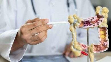 Cancer colorectal : la piste des pesticides relance le débat sur les cas précoces